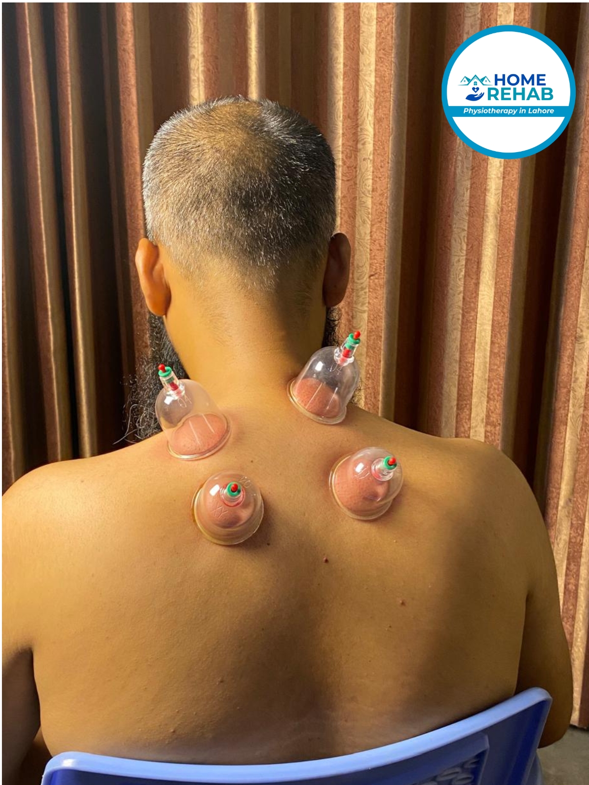 Neck cupping therapy in Lahore