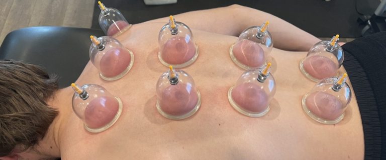 Hijama Therapy in Lahore